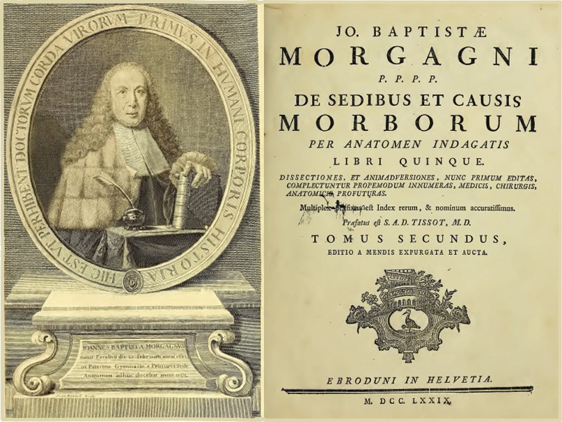 De sedibus et causis morborum per anatomen indagatis ‘Of the seats and causes of diseases investigated through anatomy’ by Giovanni Battista Morgagni, first published in 1761.