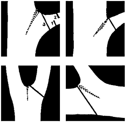 The importance of the pruning cut